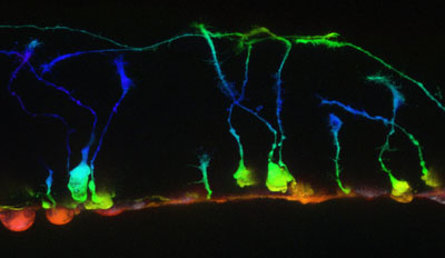 spinal commissural axons