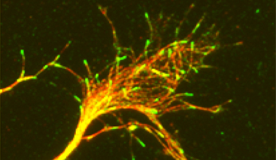 Microtubules and EB3 comets