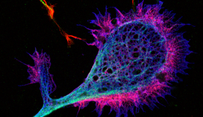 axon cytoskeleton