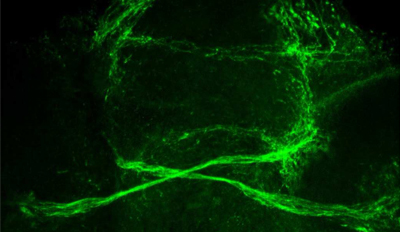 optic chiasm in zebrafish