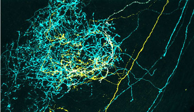 intermingled retinal arbors