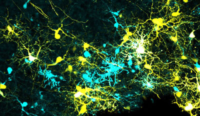 retinal ganglion cells