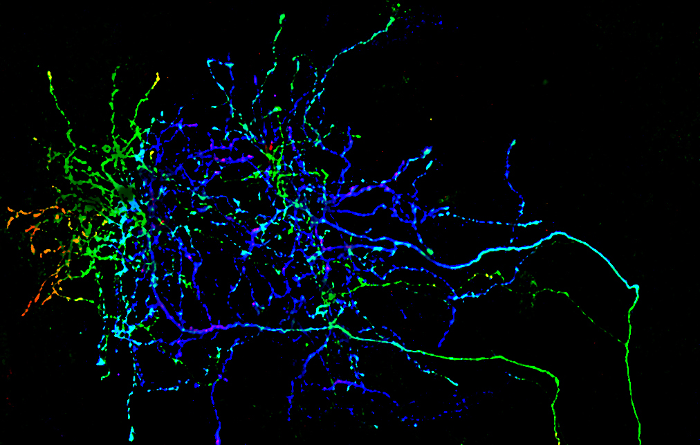 axon terminal arbor